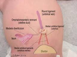 A septic abortion is an infection of the placenta and fetus (products of conception) of a previable pregnancy. Omphalitis Background Pathophysiology Etiology