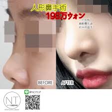 note美容外科