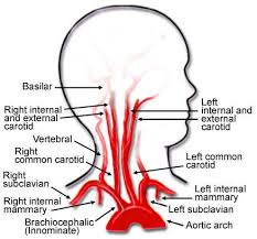 The arteries that ultimately supply the head and neck originate from the subclavian and common carotid arteries. Right Subclavian Artery Google Search Arteries Anatomy Carotid Artery Arteries