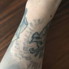 Our special technology uses lasers as a quick, painless, safe tattoo removal. Blix Clinical Aesthetics 32 Photos 19 Reviews Day Spas 514 19th Ave E Capitol Hill Seattle Wa Phone Number Services Yelp