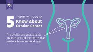 Fortunately, my instinct told me i should go to my doctor for an ob/gyn exam. Ovarian Cancer 5 Things To Know Infographic Northwestern Medicine