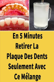 La Plaque Dentaire Est Un Probleme Cosmetique Commun Pour Les Hommes Et Les Fe En 2020 Soins Des Gencives Blanchiment Des Dents Maison Blanchir Les Dents Naturellement