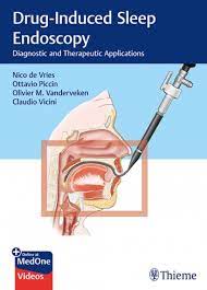 Otolaryngology Drug Induced Sleep Endoscopy