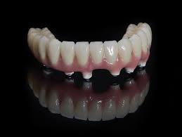 While the cost of any dental procedure can vary based they are much more expensive than dentures because each missing tooth is replaced by an implant. How Do Implant Dentures Work General And Cosmetic Dentistry Rotem Dental Care