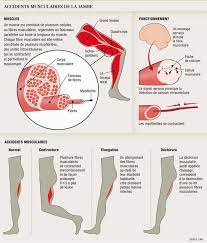 Les douleurs musculaires sportives sont causées par des facteurs biomécaniques, par l' intensité de l' entrainement ou l' inadéquation de la préparation. Le Claquage Fait Mal Mais Guerit Bien Avec Du Repos Planete Sante