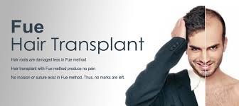 Fue hair transplant works immediately after the procedure is finished. Best Hair Transplant Clinic In Kochi Cochin Kerala Almeka Clinic Kochi