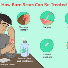 Baking soda has the ability to get rid of scab fast. How Burn Scars Are Treated
