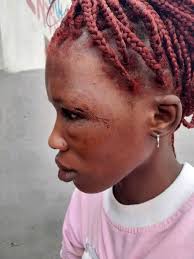 Kaos leaves to the academy, due to recieving an invitation to party of the  newest god general in the order of lorelei army,