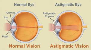 All About Astigmatism Zenni Optical