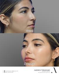 Andres Tobar Padilla MD (@dr_andrestobar) • Instagram photos and videos