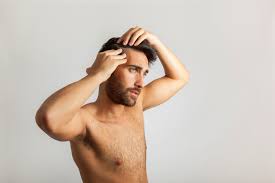 Si elle est généralement naturelle et due au renouvellement des cheveux, elle peut aussi dissimuler d'autres problèmes de santé. Perte De Cheveux Comment Differencier Calvitie Et Pelade Dhi