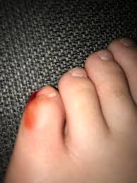 I swear stumping your pinky toe might be some of. I Had To Shit And Stubbed My Pinky Toe Havingabadday