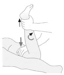 Image result for Ballottable Patella Sign