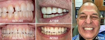 Gallery — Laurel Morello DDS