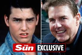 Anna is a communication expert and a life enthusiast. Inside Tom Cruise S Dramatic Face Transformation As Plastic Surgery Expert Says He Looks Swollen From Neck Face Lift