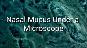 Written by adrienne bolton of adrienne bolton. Nasal Mucus Under A Microscope Youtube