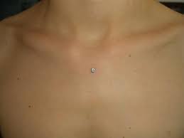 Invisible Necklace Dermal Piercing Dermalpiercing Dermal Piercing Dermal Piercing Chest Piercing