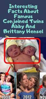 Abby and brittany hensel are conjoined twins who forged successful careers for themselves that emphasizes their individuality and experiences. Interesting Facts About Famous Conjoined Twins Abby And Brittany Hensel Fun Facts Facts Brittany