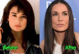 Did demi moore get plastic surgery? Demi Moore Plastic Surgery Gone Too Far