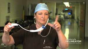 Uterine manipulation sets the surgeon up for success. Dr Crockett Rocking Cooper Surgical S Advincula Delineator Youtube