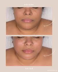 Refreshed and rejuvenated skin unlocked 🔓🫧 #licensedesthetician  #facialtreatments #organicliftfacial #image