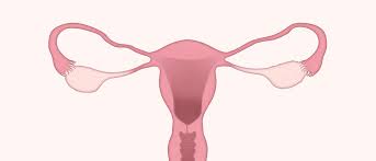 Ovarian cancer (cancer of the ovaries). Ovarian Cancer Do You Know The Symptoms Natracare