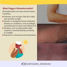Image result for Photodermatitis