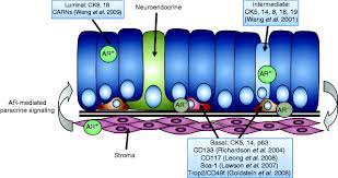 Stem Cells In Prostate Cancer Treating The Root Of The Problem In Endocrine Related Cancer Volume 17 Issue 4 2010