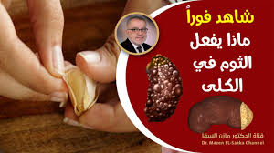 بقلم دكتور أحمد البحيرى استشارى الطب النفسى. Ø³Ø±Ø¹Ø© Ø§Ù„Ù…Ø¯ÙŠÙ†Ø© Ø§Ù„Ø³Ø±ÙŠØ¹Ø© Ø§Ù„ØªÙŠ ÙŠØ±Ø¬Ø¹ ØªØ§Ø±ÙŠØ®Ù‡Ø§ Ø¹Ù„Ø§Ø¬ Ø§Ù„Ø«ÙˆÙ… ÙˆØ§Ù„Ø¨Ø±Ø§Ù†Ø¯ÙŠ Ø§Ù„ØªØ¨ØªÙŠÙ†