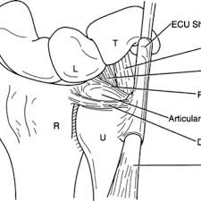 Download scientific diagram | palmer classification of tfcc traumatic injuries: Triangular Fibrocartilage Complex Tfcc Lesions As Described By Download Scientific Diagram