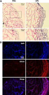 Photos draw the longitudinal section of hibiscus flower drawings. Histological Analysis Of Cellular Infiltration Into The Matrigel Plug Download Scientific Diagram