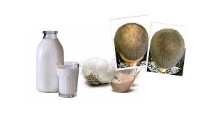 Pin By 1234567890 On Saglik Stop Hair Loss Homemade Skin Care Beauty Hacks