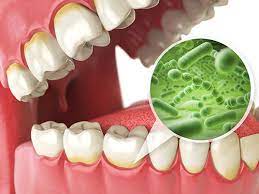 Check spelling or type a new query. 5 Reasons Why You Shouldn T Avoid That Root Canal Atlantic Family Dentistry