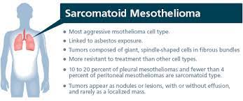 We did not find results for: Sarcomatoid Mesothelioma Symptoms Diagnosis And Treatment Asbestos And Lung Cancer