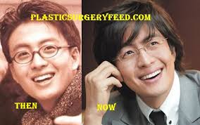 Bae yong joon and choi ji woo were one of the two biggest stars of hallyu, introducing korean dramas to all over with their landmark classic drama winter sonata. Bae Yong Joon Plastic Surgery Plastic Surgery Feed