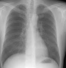 Maybe you would like to learn more about one of these? X Ray Fungsi Jenis Dan Prosedur Idn Medis