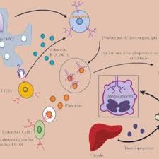Trombocitopenia grado iii, anemia grado ii microcítica hipocrómica, clínicamente con síndrome medular incompleto así como cefalea intensidad 8/10 eva, proptosis izquierda, diplopía, lesiones dérmicas nodulares en cráneo, hepato y esplenomegalia; Pdf Trombocitopenia Inmunitaria Primaria