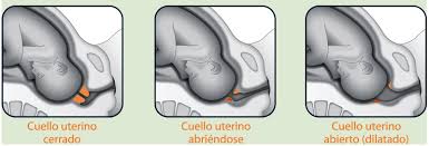 Cuantas horas dura un parto inducido. Esta Pensando Que Le Induzcan El Parto Las Guias Sumarias De Los Consumidores Ncbi Bookshelf