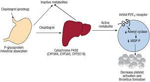 Jpm Free Full Text Pharmacogenomic Impact Of Cyp2c19 Variation On Clopidogrel Therapy In Precision Cardiovascular Medicine Html