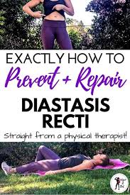 How to prevent diastasis recti reddit. How To Prevent Diastasis Recti From Getting Worse Arxiusarquitectura