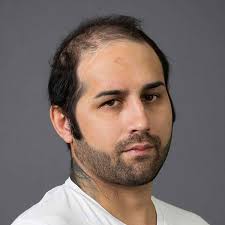 Systems4hairloss Ltd