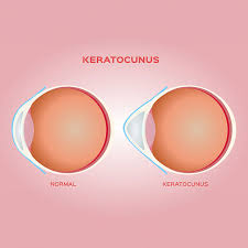 Image result for Sclerocroton