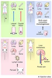 I'm a strong person but all of this is making me worry. Ijms Free Full Text The In Vivo Selection Method In Breast Cancer Metastasis Html