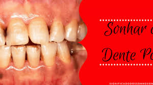 Sonhar Com Dente Podre Imperdivel Significado Dos Sonhos Online Sonhar com dente é algo corriqueiro. sonhar com dente podre imperdivel