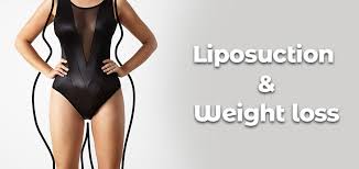At most, you can expect to lose anywhere from 1 to 10 pounds of fat. How Much Weight Can You Lose With Liposuction All Details Natural Hair Turkey