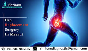 Hip Replacement Clinic In Meerut Shriram Knee Replacement Center Dr Atul Rastogi Hip Replacement Knee Osteoarthritis Hip Replacement Surgery