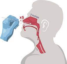 The swab handle that extends. Covid 19 Nasal Swab Collection Clinical Pathology Laboratories