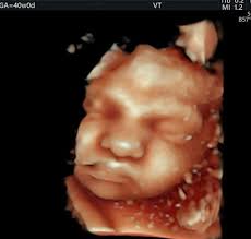 Brittany Bee Scheeringa RDMS(OB/ABD) RDCS(Fetal Echo)