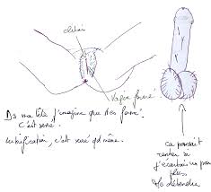 Lorsque lhypertonicité impacte la vie sexuelle : le vaginisme et léjaculation  précoce