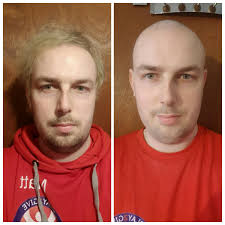 Play2Give head shave challenge for lung cancer research